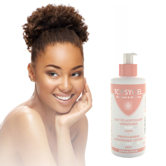 3-Pack of Stretch-Marks Lightening Body Lotion
