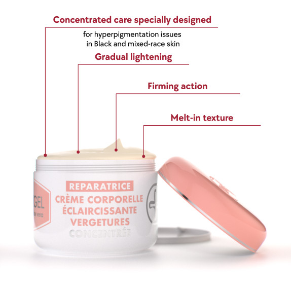 Stretch-Marks Lightening Body Cream