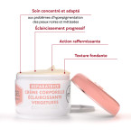 Stretch-Marks Lightening Body Cream