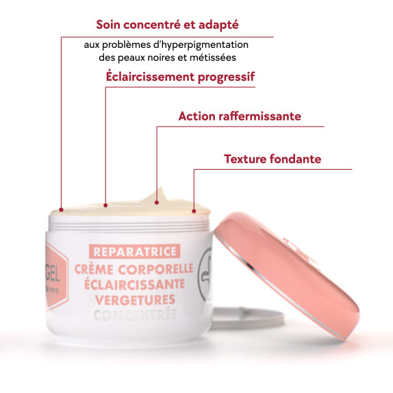 Stretch-Marks Lightening Body Cream