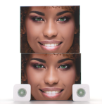 Green Lenses